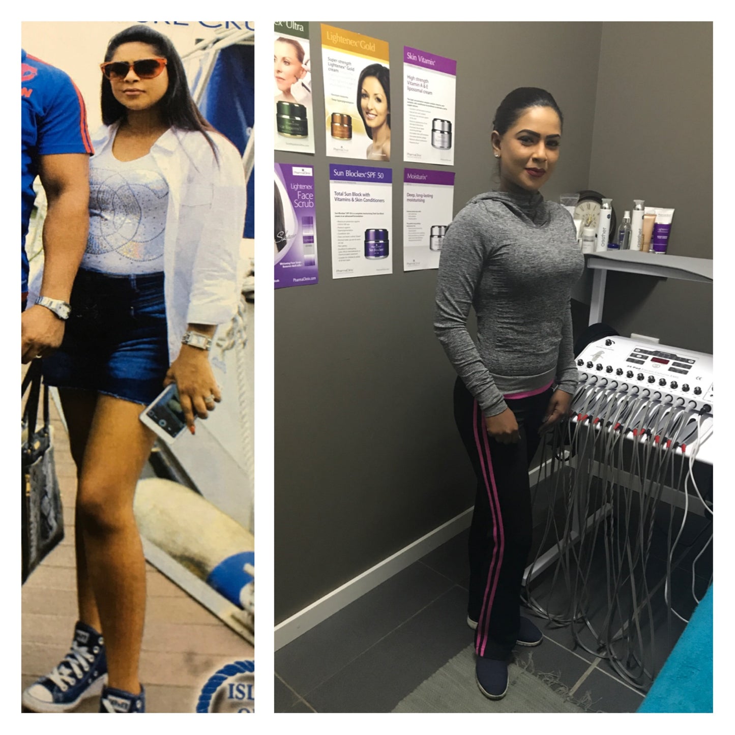 Computerized Slimming Machines