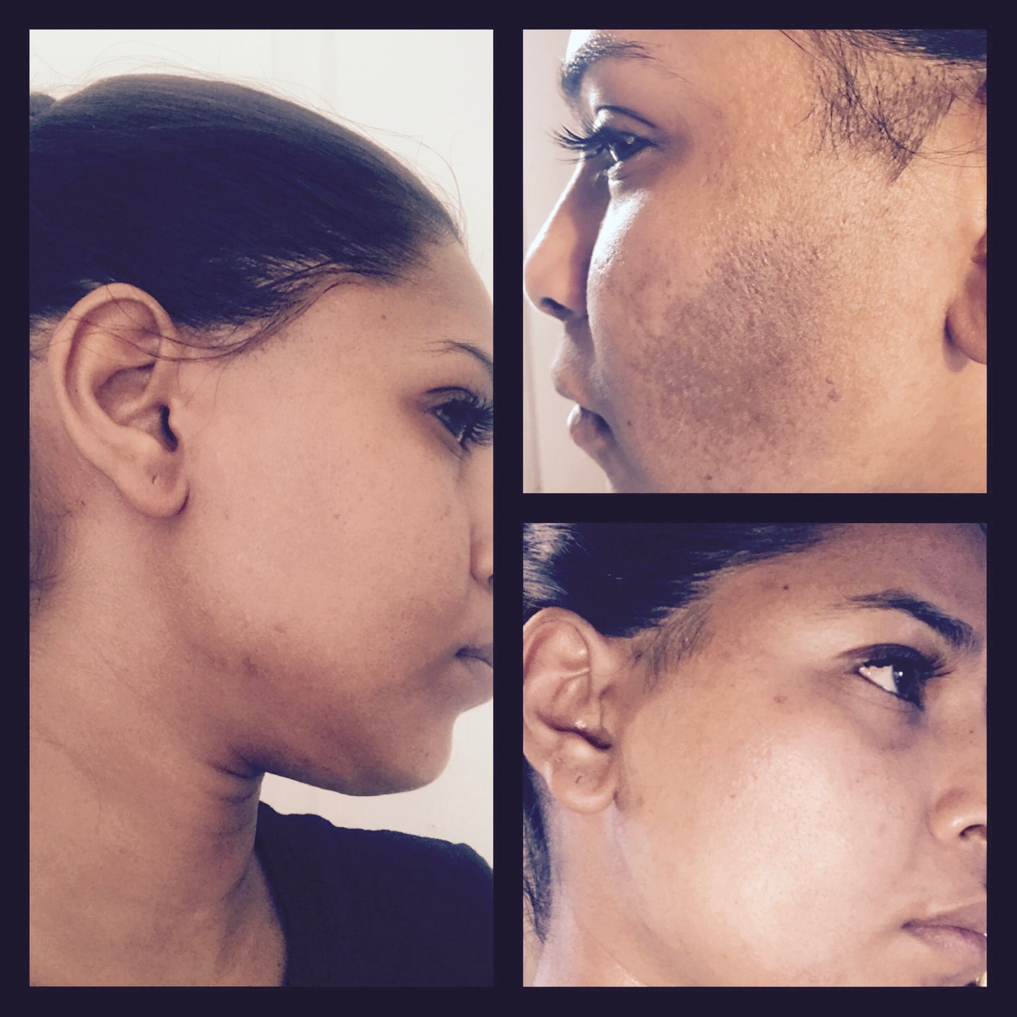 Pigmentation Corrector/Melanin Blocker