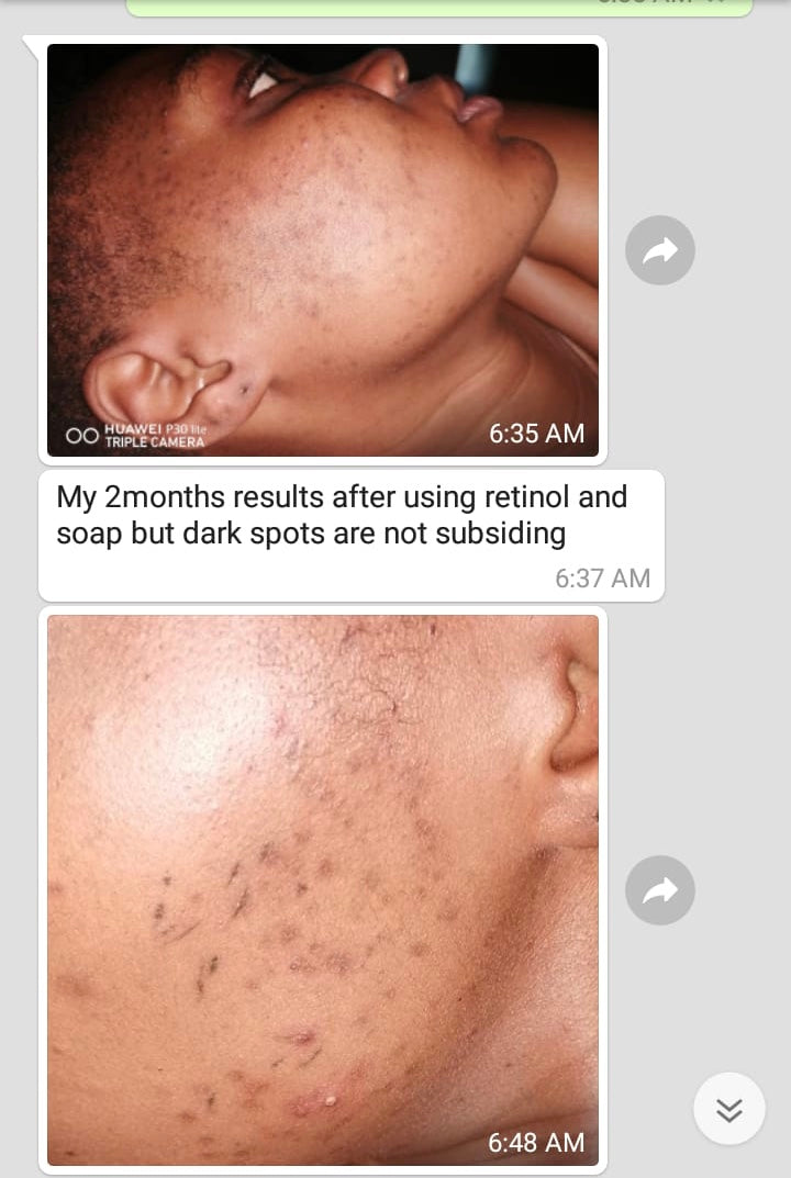 Retinol Serum